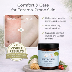 Baby Eczema Relief Balm